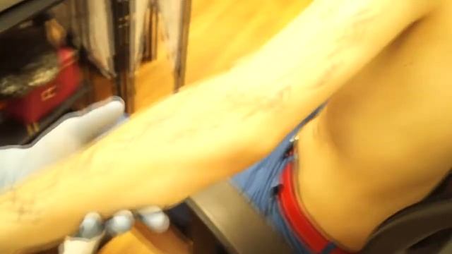 Лазерное удаление татуировки смотреть онлайн