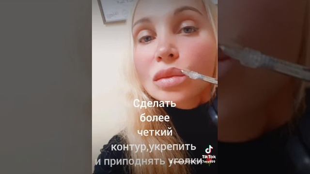 Какие области на лице можно скорректировать филлером? смотреть онлайн