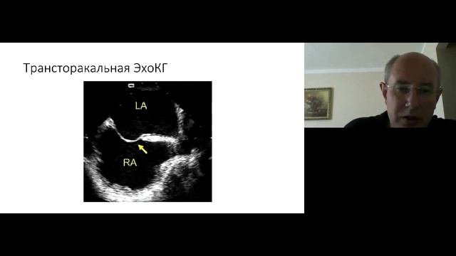 Современные возможности функциональной диагностики