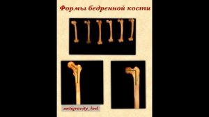ПОПЕРЕЧНЫЙ ШПАГАТ. Почему не получается сесть на поперечку? Как сесть на поперечный шпагат?