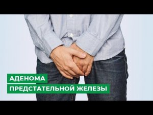 Аденома предстательной железы. Симптомы, лечение. Можно ли обойтись без операции?