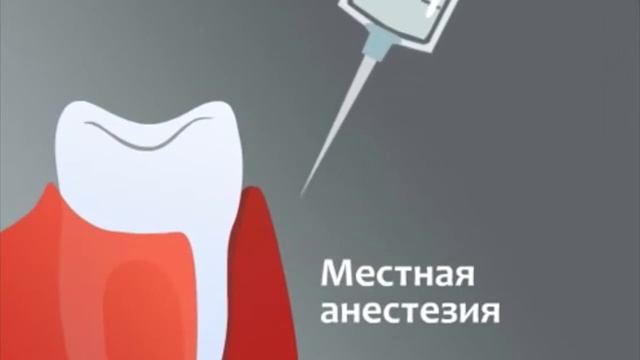 Лечние десен аппартом Vector orange смотреть онлайн