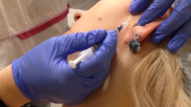 АирисКом студенты учатся: мезоботокс. Введение препарата для лифтинга нижней части лица. смотреть онлайн