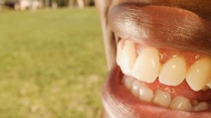 ЗАЧЕМ ЧИСТИТЬ ЗУБЫ, Что будет если долго не чистить зубы?