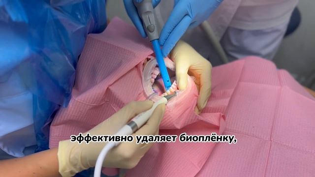 AIRFLOW® Prophylaxis Master-профгигиена на Швейцарском аппарате по протоколу GBT