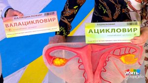 Болезни любви. Половой герпес. Жить здорово! Фрагмент выпуска от 23.05.2019