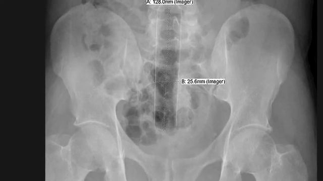 Внутренний мир самые странные вещи застрявшие внутри смотреть онлайн
