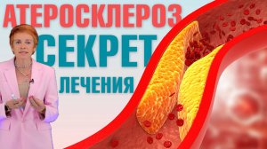 Как помочь себе при атеросклерозе? Атеросклероз - что это такое и как его  лечить