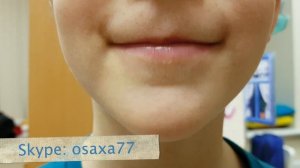 Слабый кончик языка. "Лошадка" не получается. Что делать? Этап 1