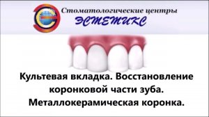 Культевая вкладка, восстановление коронковой части зуба, металлокерамическая коронка