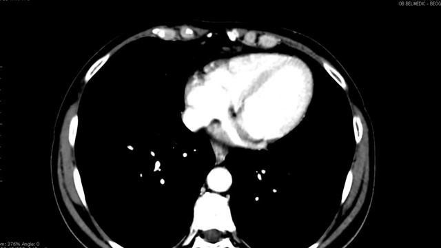 Что будет, если есть дыню каждый день? смотреть онлайн