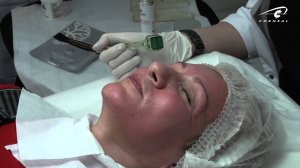 Микронидлинг - довольные ощущения на лице