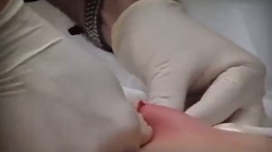 Самый большой прыщ на земле | Kill George