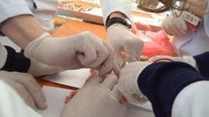 Резекція ребра ( студент медик)