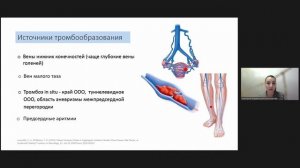 КАРДИОЭМБОЛИЧЕСКИЙ ИНСУЛЬТ: ИСТОЧНИКИ ЭМБОЛИИ, МЕТОДЫ ХИРУРГИЧЕСКОЙ И МЕДИКАМЕНТОЗНОЙ ПРОФИЛАКТИКИ