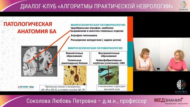 ДИАЛОГ-КЛУБ "АЛГОРИТМЫ ПРАКТИЧЕСКОЙ НЕВРОЛОГИИ"
