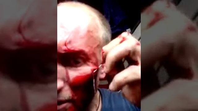 Как сшить лицо! смотреть онлайн