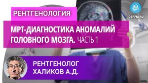 Рентгенолог Халиков А.Д.: МРТ-диагностика аномалий головного мозга. Часть1