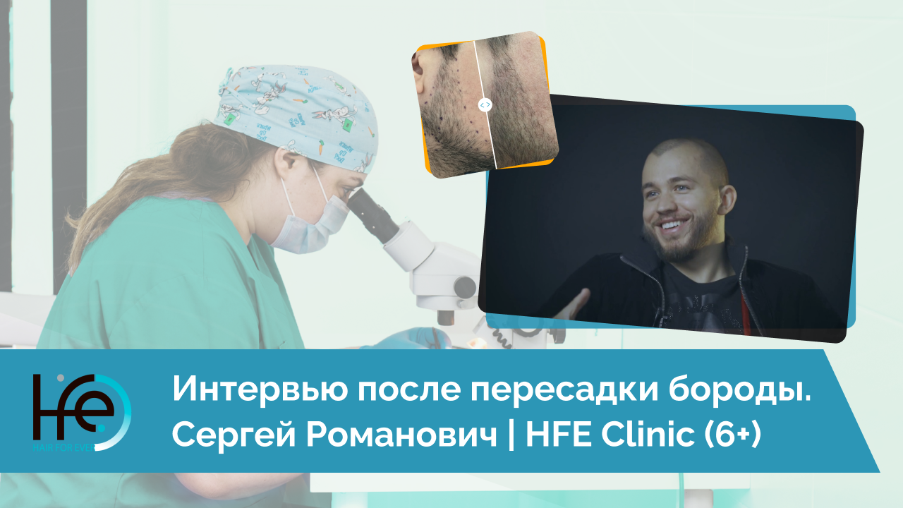 Интервью после пересадки бороды. Сергей Романович | HFE Clinic (6+)