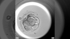 Развитие эмбрионов. Запись получена с помощью самого современного эмбриоскопа EMBRYOSCOPE+.