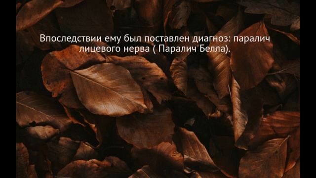 Паралич Белла после прививки