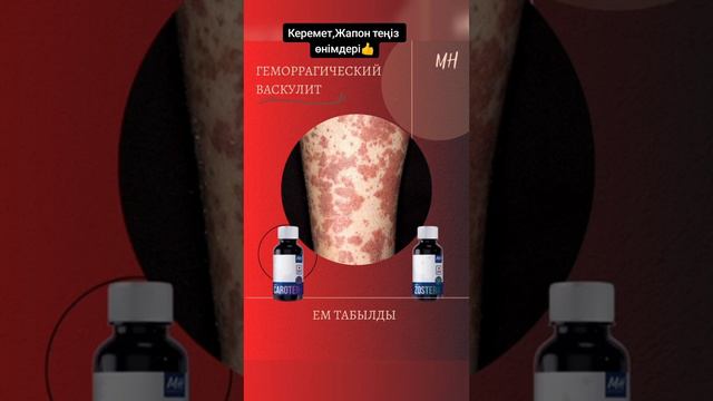 Геморрагический васкулит.Жапондық өнімдер. Ақпарат  алу үшін  87053364969 хабарласыңыз.