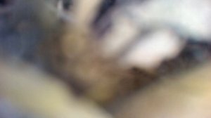 ОСЫ напали на человека (нападение ос)