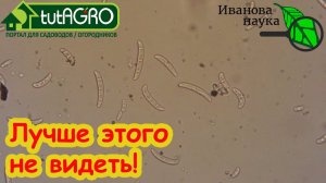 ЛУЧШЕ НА ЭТО НЕ СМОТРЕТЬ! Сколько ЗАРАЗЫ в маленькой капле воды? Как нам вылечить окончательно?