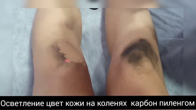 карбон пиленг