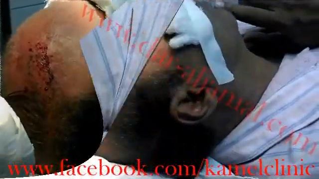 Gentle lase смотреть онлайн