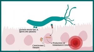 Helicobacter Pylori Infection | Gastric ulcer | Causes, Signs and Symptoms, Diagnosis and Treatment