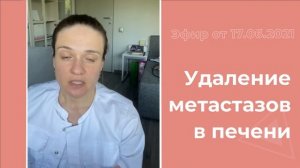 Удаление метастазов в печени