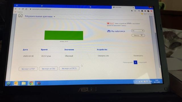 Vyvo часы, медицинские данные о состоянии здоровья! смотреть онлайн