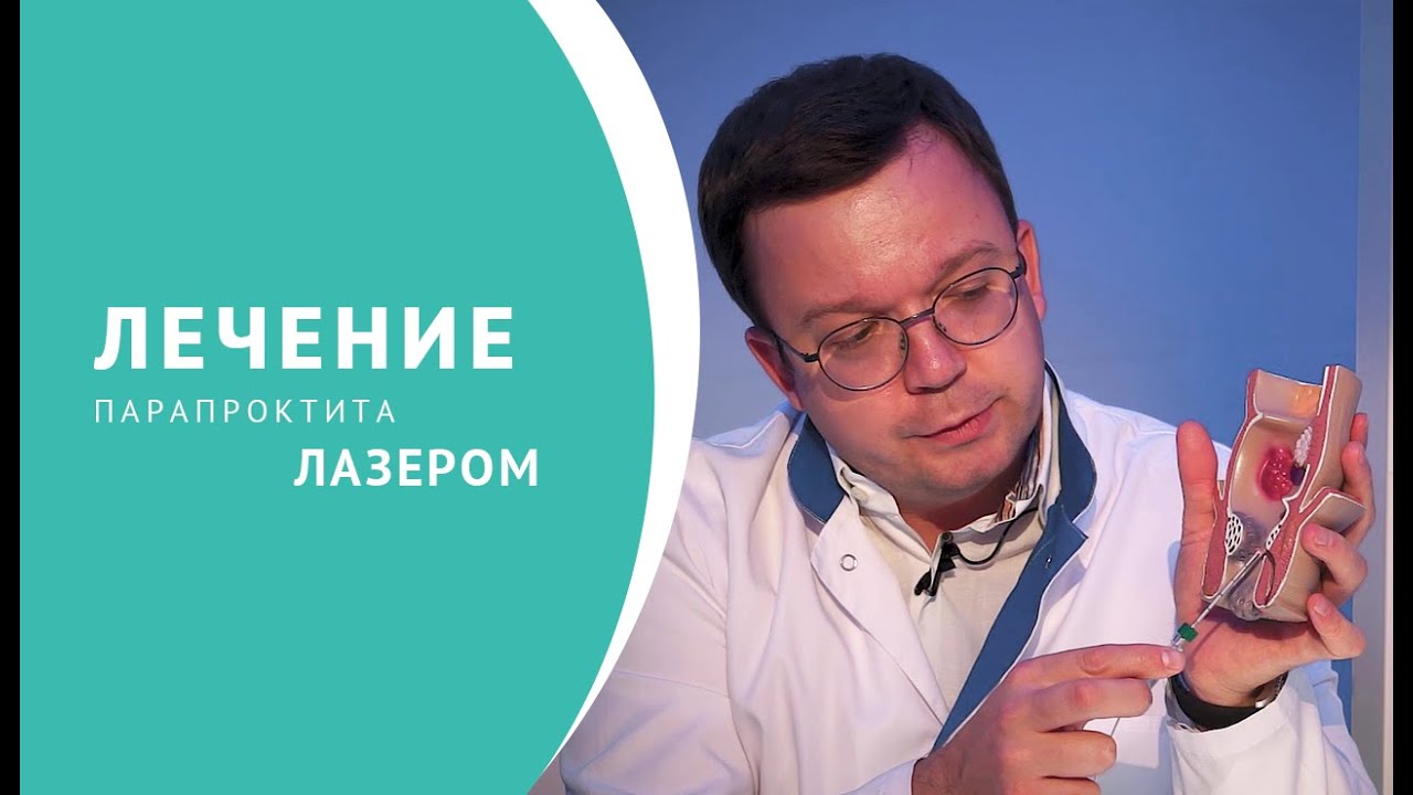 Лечение парапроктита лазером смотреть онлайн