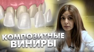 Композитные виниры на здоровые зубы - это вредно?