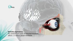 Концепт искусственного глаза