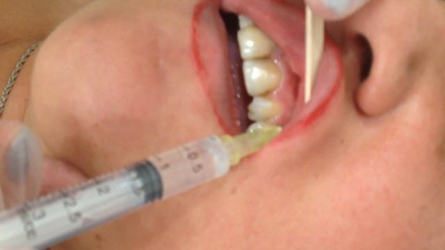 Аириском студенты учатся практические занятия по инъекциям смотреть онлайн