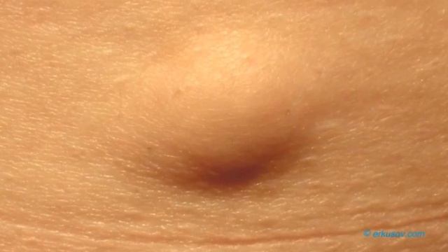 Պարանոցի հետ կապված առողջական խնդիրներ․ կարևոր խորհուրդներ смотреть онлайн