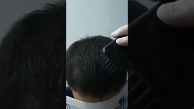 Пересадка волосы УЗБЕКИСТАНЕ ТЕЛЕФОН ☎+998970004898 ДОКТОР ТРИЕХОЛОК