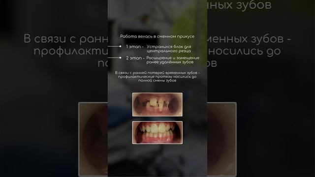 Кейс ортодонтия
