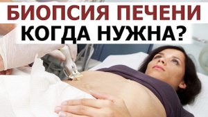 Биопсия печени при ожирении. Причина стеатогепатита диагностика. Прогрессирование фиброза печени.