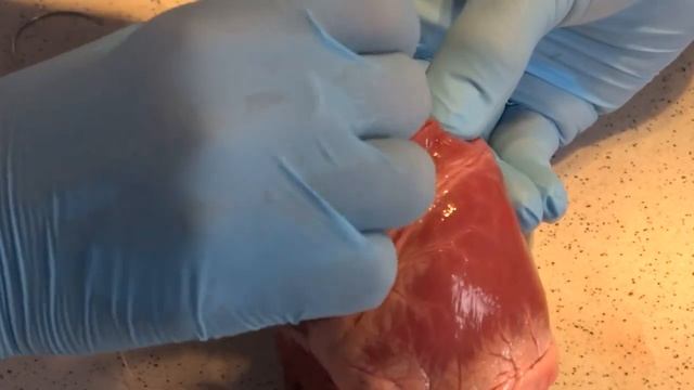 ушивание ран сердца на англ смотреть онлайн