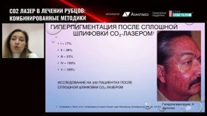 ✅Тема: СО2 лазер в лечении рубцов: комбинированные методики