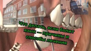 Что делать, если болит язык — причины и способы лечения