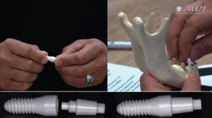 Керамические импланты из Германии. Съемка ВИДЕО для медицины.