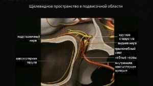 КТ диагностика рака шеи, часть 1, введение, анатомия