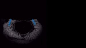 П. Л. Б. 5 Часов (100x Скорость)