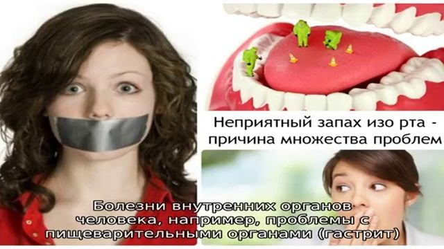 Неприятный запах изо рта смотреть онлайн