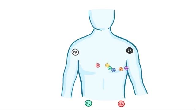 ЭЛЕКТРОКАРДИОГРАФИЯ — основы ЭКГ смотреть онлайн