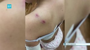 01.02.2024 В Северодвинске детей покусала собака